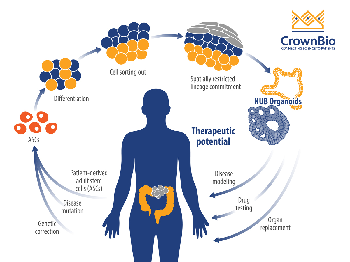 Using Organoids To Understand Colorectal Cancer Mechanisms And Development