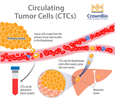 metastasis via CTCs, by cells escaping the primary tumor and traveling via blood vessels