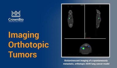 Bioluminescent imaging of a spontaneously metastatic, orthotopic tumor model, the A549 lung cancer model