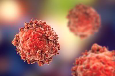 Imaging leukemia white blood cells from systemic cancer