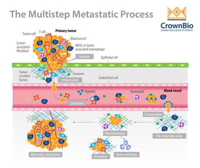 diagram of the multistep process of tumor metastasis