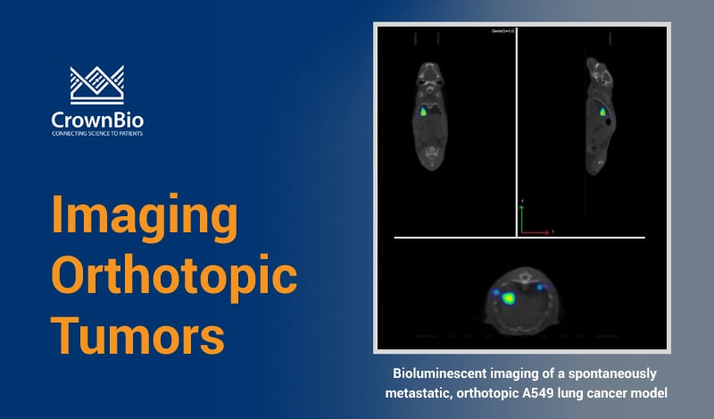 Bioluminescent imaging of a spontaneously metastatic, orthotopic tumor model, the A549 lung cancer model