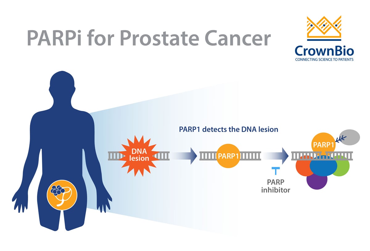 The Latest Developments on PARP Inhibitors for Prostate Cancer Treatment