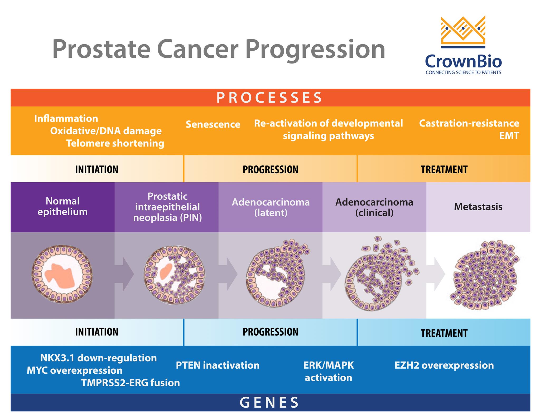 progression of prostate cancer from initiation to metastatic, castration resistant disease, including genetic alterations and cellular processes