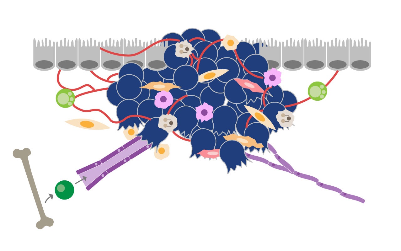 Overcoming the Tumor Microenvironment and Heterogeneity to Improve Preclinical Response