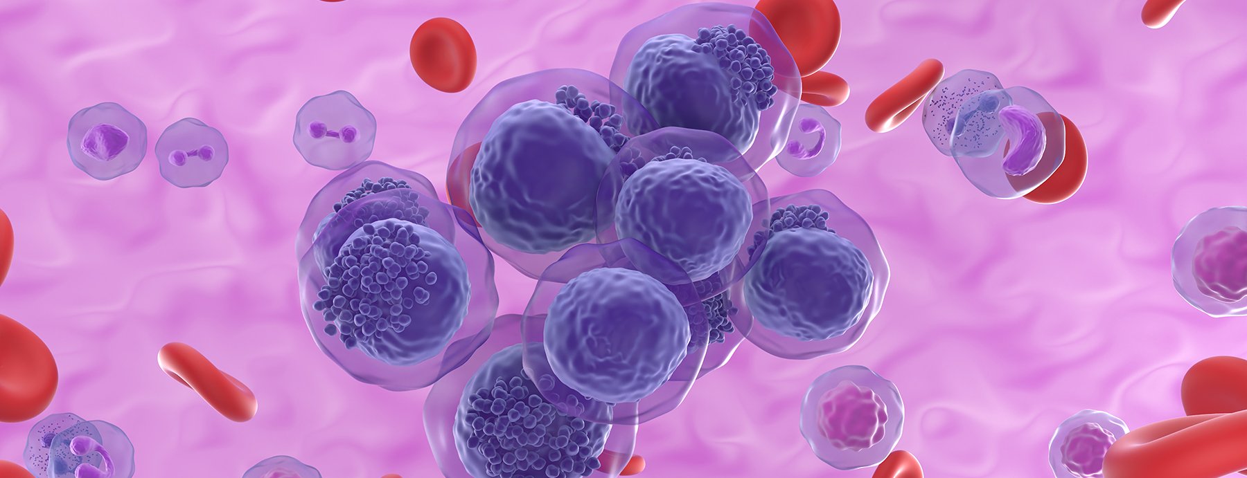The Role of Biomarkers in AML Drug Discovery
