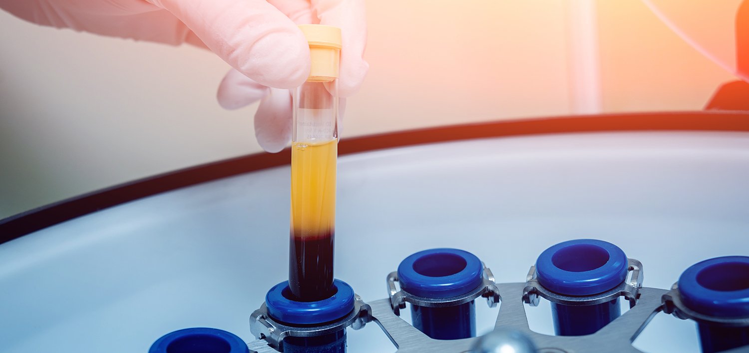 Top 5 quality factors that make or break biospecimen research