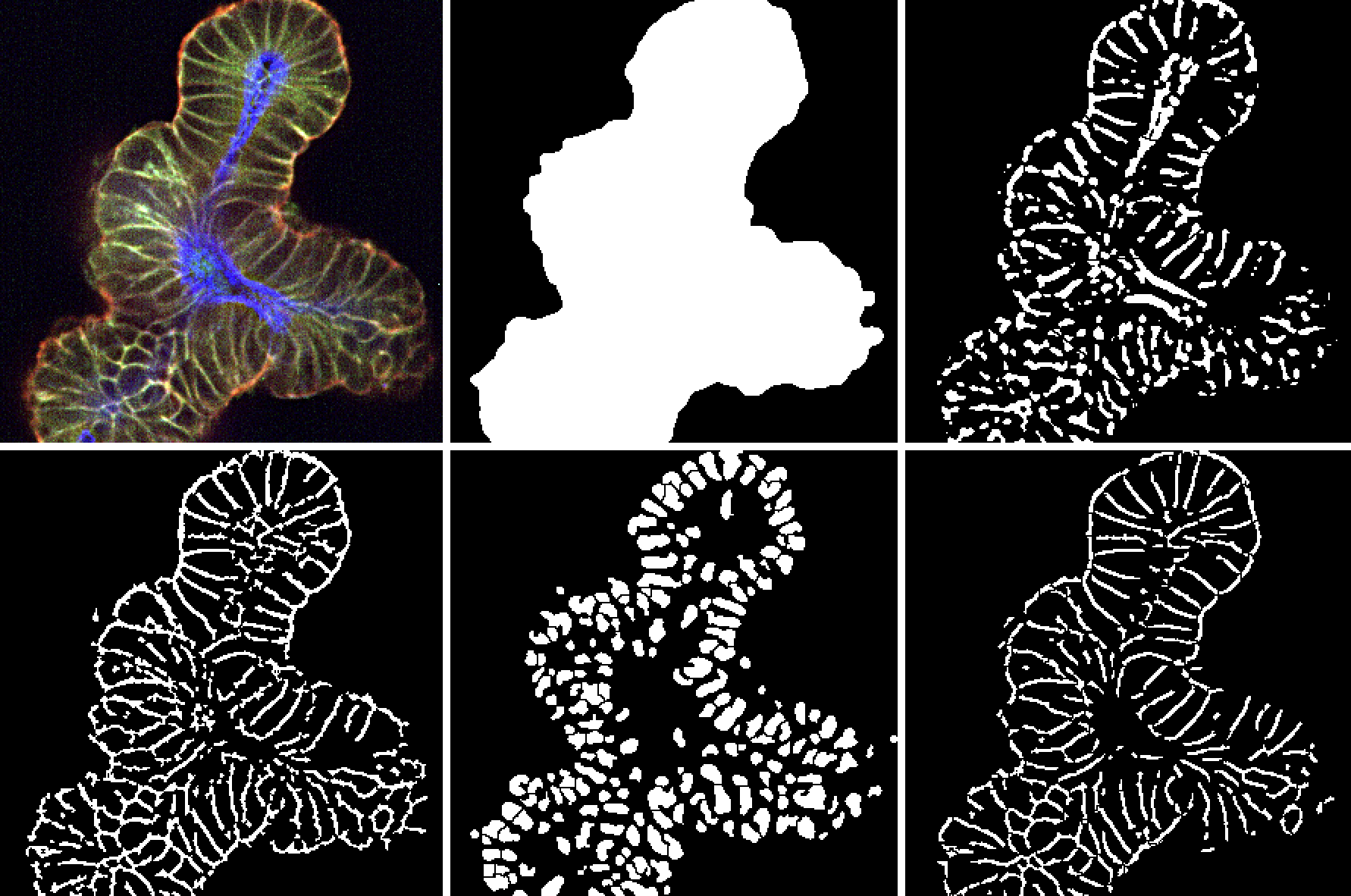 How Can High Content Imaging Transform Your Cancer Research?