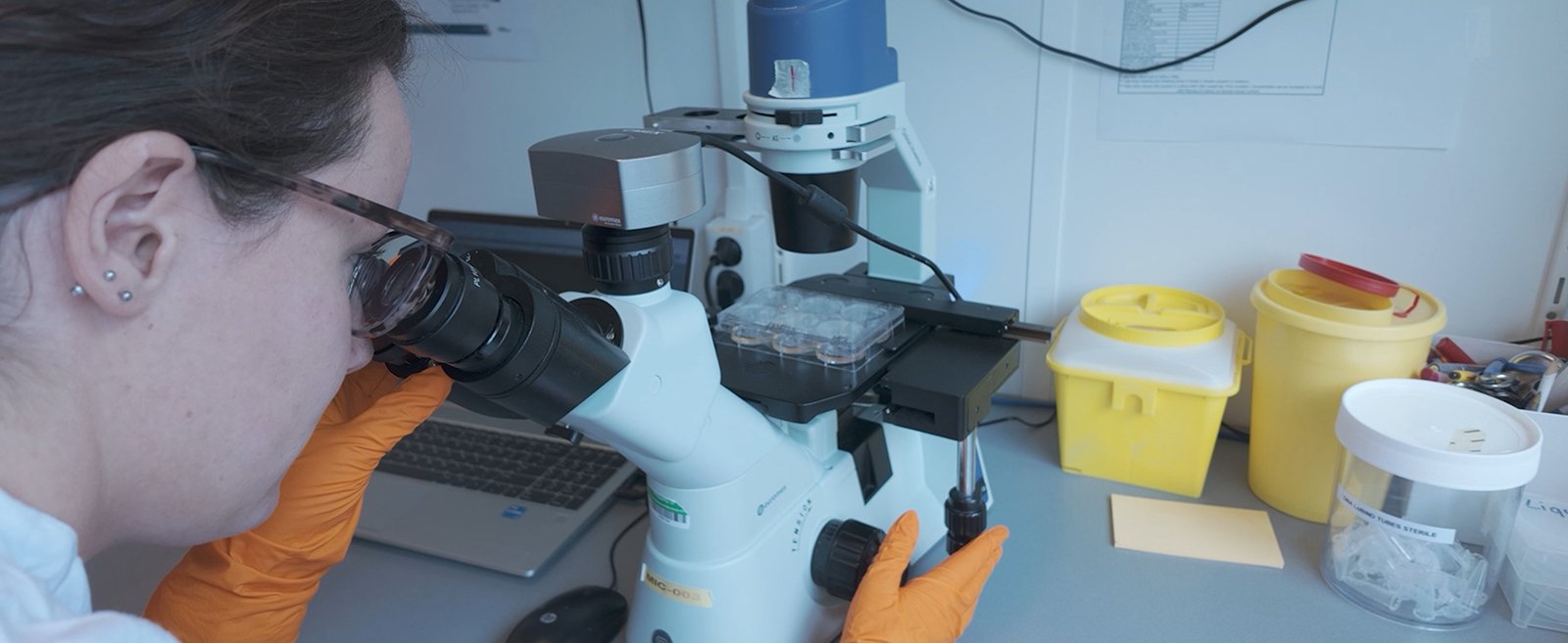 Designing Immuno‑Oncology Studies with Humanized Mouse Models: A Practical Primer