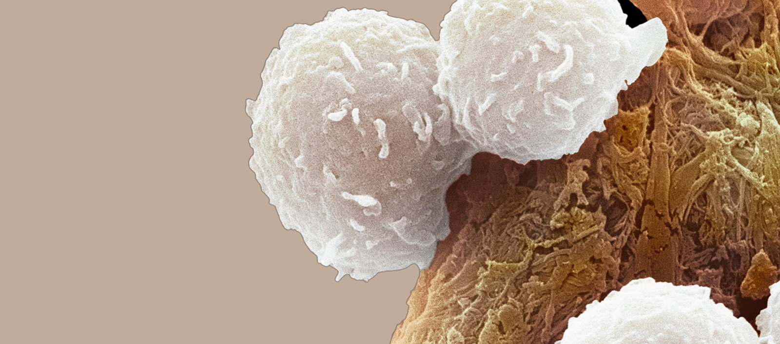 Which Preclinical Cancer Model Looks Most Like a Patient's Tumor? A New Multiomic Benchmark Has an Answer