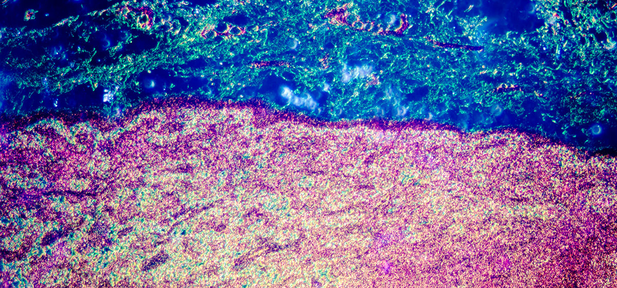 Spatial Data Analysis of Patient Tumor Samples: A New Frontier in Oncology Research