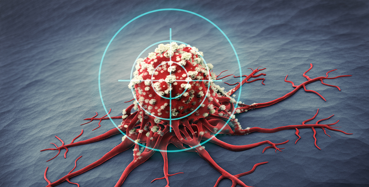 Using PDX Models to Tackle Acquired Drug Resistance to Targeted Cancer Therapies