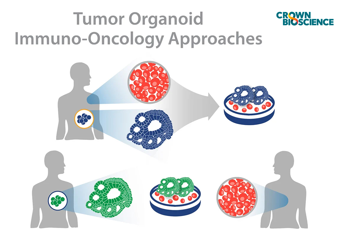 How to Use Tumor Organoids for Immuno-Oncology Applications